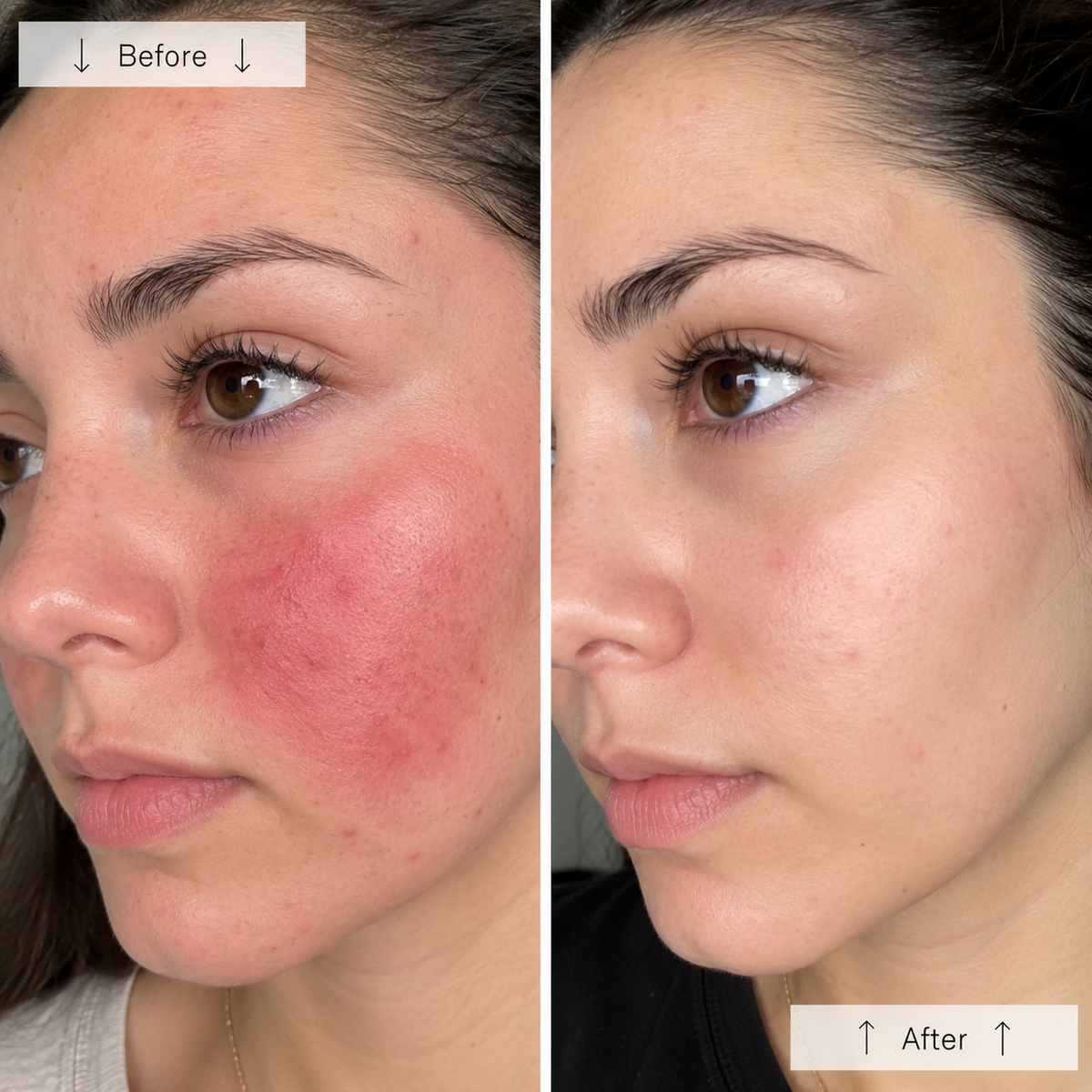 Risultato Kit Rituale — before after rossore